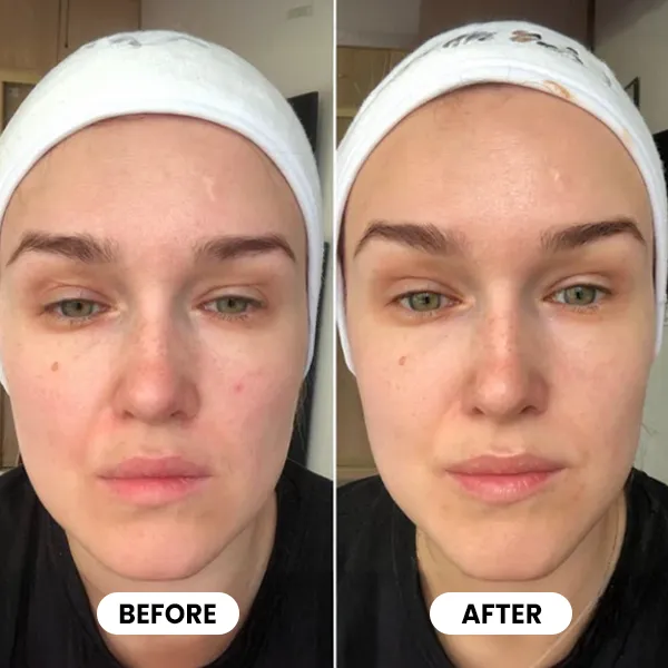 Glokore LED Skin Sculptor
